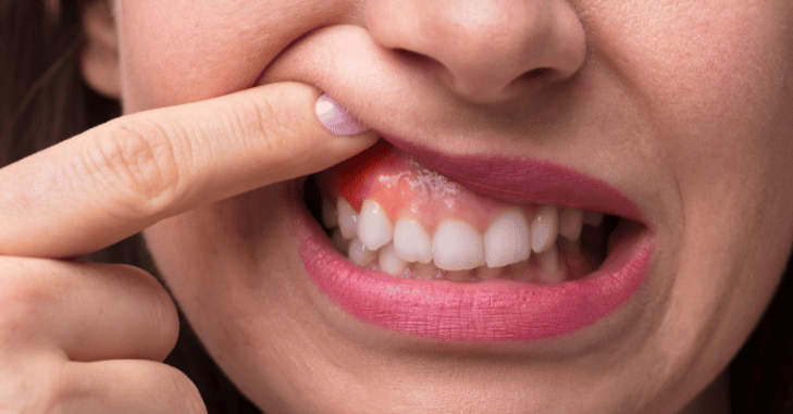 Dentist examining a patient's gums during a checkup