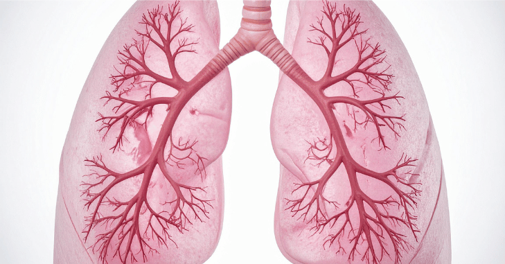 Illustration of airways affected by inhaled dust